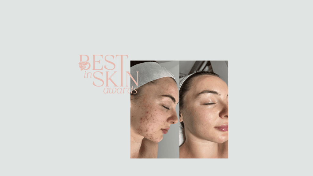Shine Skin and Body